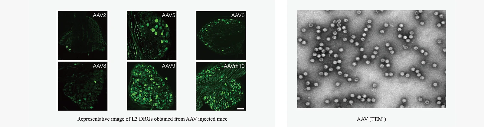 Fluorescence images of L3 dorsal root ganglia from AAV-injected mice across six serotypes, and a transmission electron microscopy image of purified AAV particles