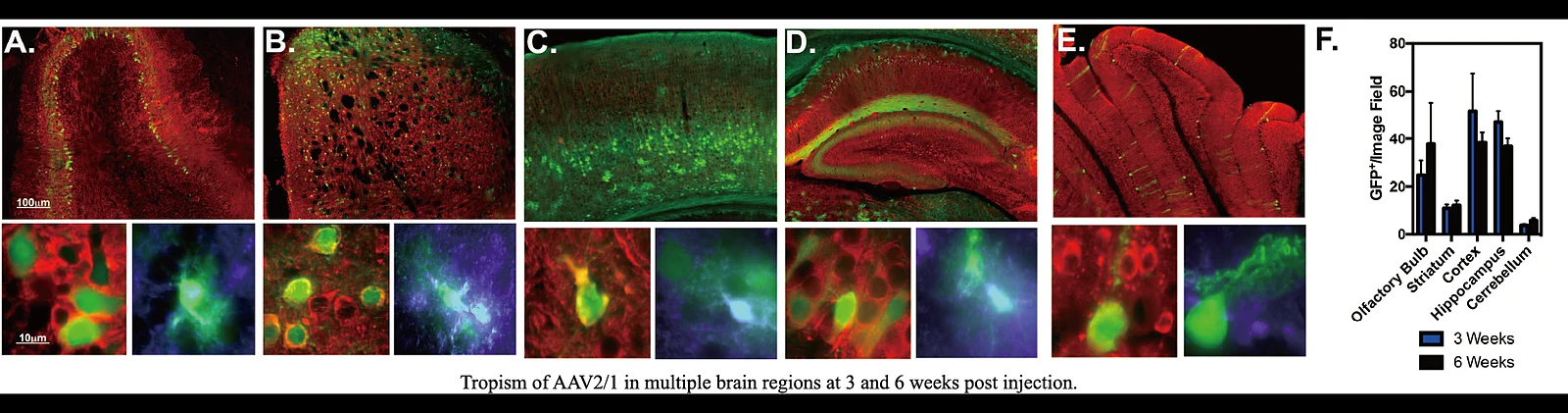Fluorescence images of AAV2/1 tropism in multiple mouse brain regions with quantified GFP-positive cells