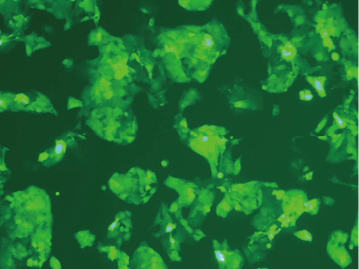 Fluorescence microscopy image of GFP expression in HepG2 cells after lentiviral transduction