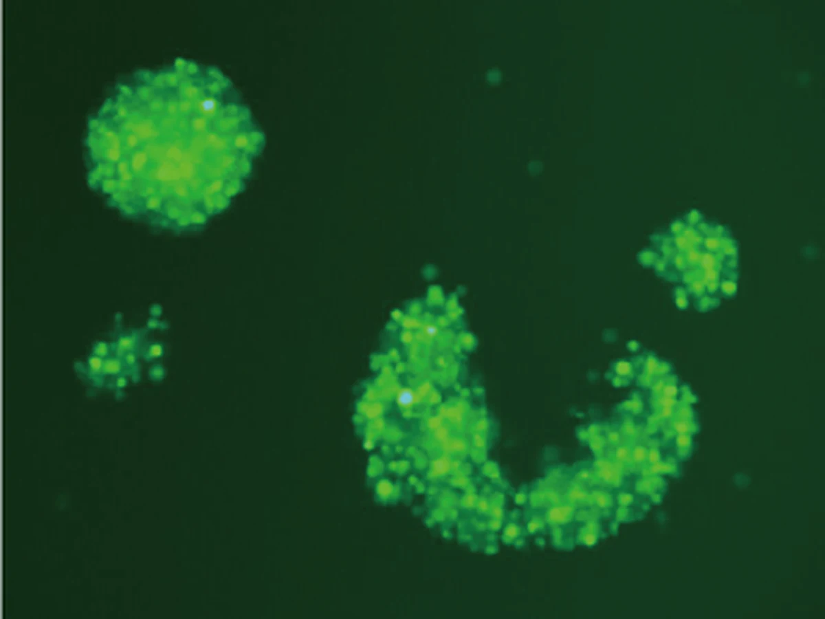 Fluorescence microscopy image of GFP expression in NK-92 cells after lentiviral transduction