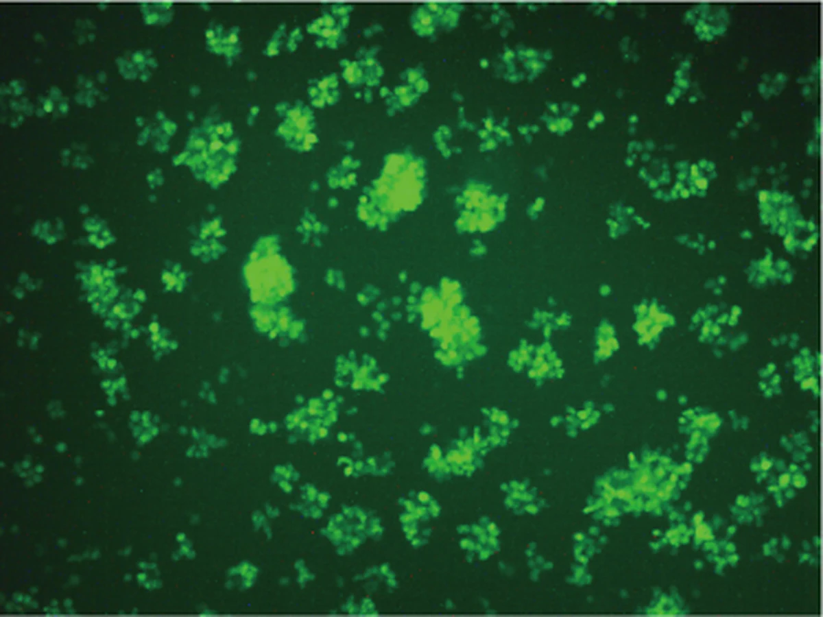 Fluorescence microscopy image of GFP expression in OCI-LY8 cells after lentiviral transduction