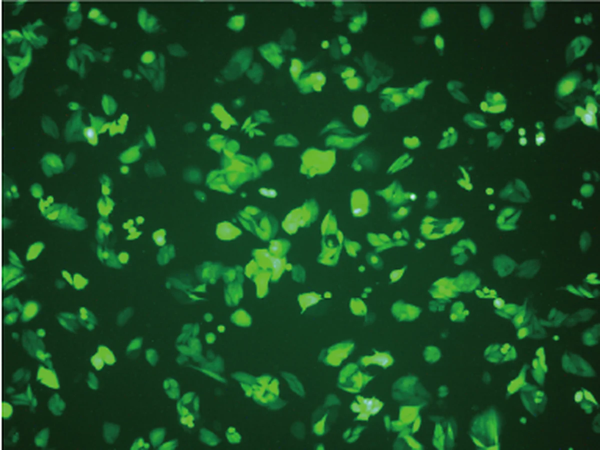 Fluorescence microscopy image of GFP expression in SW480 cells after lentiviral transduction