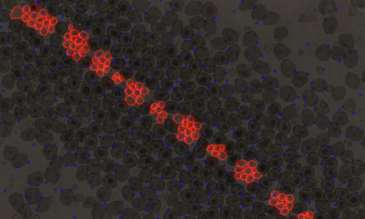 Fluorescence microscopy image of mCherry-positive colonies after antibiotic selection following MMLV retroviral transduction